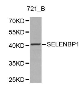 Selenium Binding Protein 1 Antibody - Western blot of SELENBP1 pAb in extracts from 721_B cells.