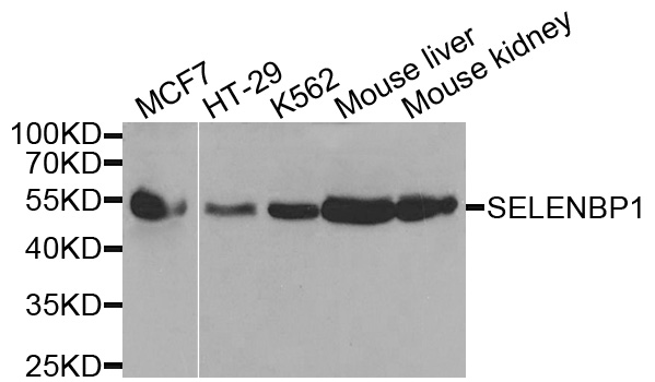 Selenium Binding Protein 1 Antibody - Western blot analysis of extracts of various cells.