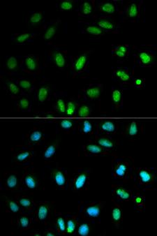 Selenium Binding Protein 1 Antibody - Immunofluorescence analysis of HeLa cells.