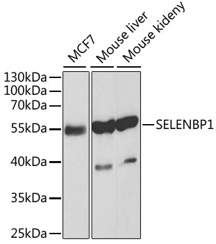 Selenium Binding Protein 1 Antibody - Western blot analysis of extracts of various cell lines, using SELENBP1 antibody at 1:1000 dilution. The secondary antibody used was an HRP Goat Anti-Rabbit IgG (H+L) at 1:10000 dilution. Lysates were loaded 25ug per lane and 3% nonfat dry milk in TBST was used for blocking. An ECL Kit was used for detection.