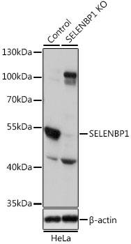 Selenium Binding Protein 1 Antibody - Western blot analysis of extracts from normal (control) and SELENBP1 knockout (KO) HeLa cells, using SELENBP1 antibodyat 1:1000 dilution. The secondary antibody used was an HRP Goat Anti-Rabbit IgG (H+L) at 1:10000 dilution. Lysates were loaded 25ug per lane and 3% nonfat dry milk in TBST was used for blocking. An ECL Kit was used for detection and the exposure time was 5s.