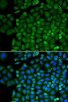 Selenium Binding Protein 1 Antibody - Immunofluorescence analysis of HeLa cells using SELENBP1 antibody. Blue: DAPI for nuclear staining.