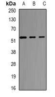 Selenium Binding Protein 1 Antibody - Western blot analysis of SELENBP1 expression in HT29 (A); K562 (B); mouse kidney (C) whole cell lysates.