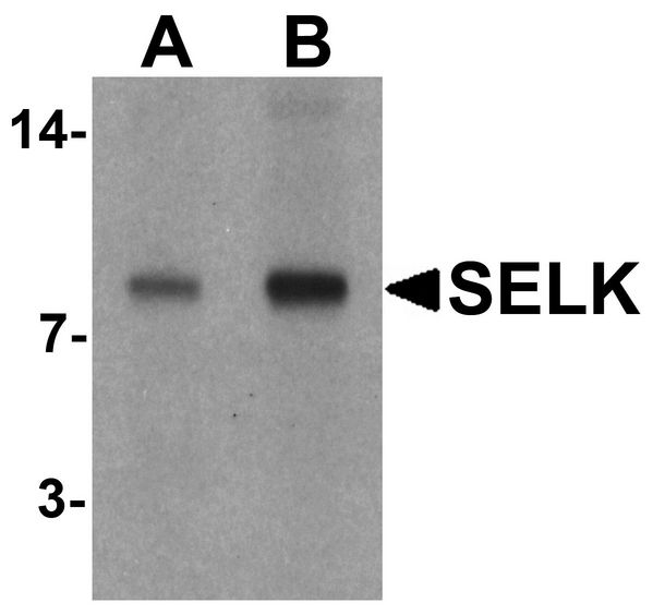 SELK / Selenoprotein K Antibody - Western blot analysis of SELK in A20 cell lysate with SELK antibody at (A) 1 and (B) 2 ug/ml.