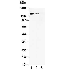 SELL / L-Selectin / CD62L Antibody - Western blot testing of L-Selectin antibody and Lane 1: recombinant mouse protein 10ng; 2: 5ng; 3: 2.5ng