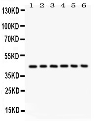 SELL / L-Selectin / CD62L Antibody - CD62L antibody Western blot. All lanes: Anti CD62L at 0.5 ug/ml. Lane 1: Human Placenta Tissue Lysate at 50 ug. Lane 2: JURKAT Whole Cell Lysate at 40 ug. Lane 3: CEM Whole Cell Lysate at 40 ug. Lane 4: HL60 Whole Cell Lysate at 40 ug. Lane 5: Rat Spleen Tissue Lysate at 50 ug. Lane 6: Mouse Spleen Tissue Lysate at 50 ug. Predicted band size: 42 kD. Observed band size: 42 kD.