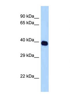 SELL / L-Selectin / CD62L Antibody - SELL / L-Selectin antibody Western blot of HepG2 Cell lysate. Antibody concentration 1 ug/ml.  This image was taken for the unconjugated form of this product. Other forms have not been tested.