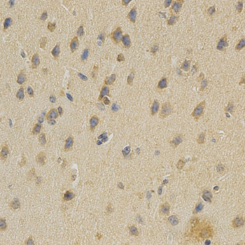 SELL / L-Selectin / CD62L Antibody - Immunohistochemistry of paraffin-embedded mouse brain using SELL antibody at dilution of 1:200 (x400 lens).