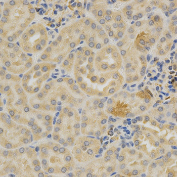 SELL / L-Selectin / CD62L Antibody - Immunohistochemistry of paraffin-embedded mouse kidney using SELL antibody at dilution of 1:200 (x400 lens)