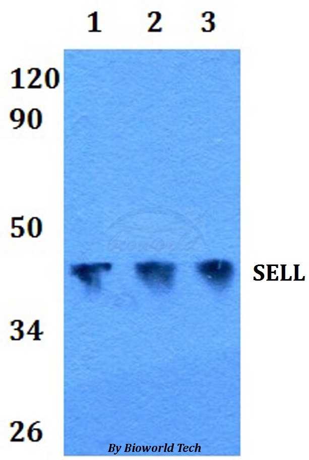 SELL / L-Selectin / CD62L Antibody - Western blot of SELL antibody at 1:500 dilution Line1:A549 whole cell lysate Line2:PC12 whole cell lysate Line3:sp20 whole cell lysate.