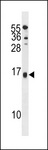 SELM / Selenoprotein M Antibody - SELM Antibody western blot of NCI-H292 cell line lysates (35 ug/lane). The SELM antibody detected the SELM protein (arrow).