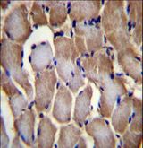 SELN / SEPN1 Antibody - SEPN1 Antibody immunohistochemistry of formalin-fixed and paraffin-embedded human skeletal muscle followed by peroxidase-conjugated secondary antibody and DAB staining.
