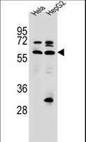 SELN / SEPN1 Antibody - SEPN1 Antibody western blot of HeLa,HepG2 cell line lysates (35 ug/lane). The SEPN1 antibody detected the SEPN1 protein (arrow).