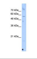 SELN / SEPN1 Antibody - HepG2 cell lysate. Antibody concentration: 1.0 ug/ml. Gel concentration: 12%.  This image was taken for the unconjugated form of this product. Other forms have not been tested.