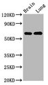 SELN / SEPN1 Antibody - Western Blot Positive WB detected in: Rat brain tissue, Rat lung tissue All Lanes: SELENON antibody at 4.2µg/ml Secondary Goat polyclonal to rabbit IgG at 1/50000 dilution Predicted band size: 66, 63 KDa Observed band size: 66 KDa