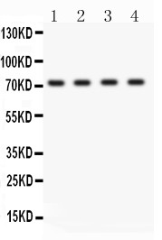 SELP / P-Selectin / CD62P Antibody - ABCG2 antibody, PB9364, Western blot. All lanes: Anti ABCG2 (PB9364) at 0.5 ug/ml. Lane 1: Human Placenta Tissue Lysate at 50 ug. Lane 2: HELA Whole Cell Lysate at 40 ug. Lane 3: PANC Whole Cell Lysate at 40 ug. Lane 4: COLO320 Whole Cell Lysate at 40 ug. Predicted band size: 72 kD. Observed band size: 72 kD.