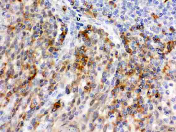 SELP / P-Selectin / CD62P Antibody - IHC analysis of CD62P using anti-CD62P antibody. CD62P was detected in paraffin-embedded section of Human Tonsil Tissue. Heat mediated antigen retrieval was performed in citrate buffer (pH6, epitope retrieval solution) for 20 mins. The tissue section was blocked with 10% goat serum. The tissue section was then incubated with 1µg/ml rabbit anti-CD62P Antibody overnight at 4°C. Biotinylated goat anti-rabbit IgG was used as secondary antibody and incubated for 30 minutes at 37°C. The tissue section was developed using Strepavidin-Biotin-Complex (SABC) with DAB as the chromogen.