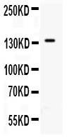 SELP / P-Selectin / CD62P Antibody - Western blot - Anti-P-Selectin Antibody