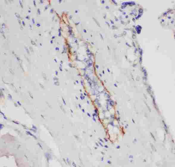 SELP / P-Selectin / CD62P Antibody - anti-CD62P antibody, IHC(P): Human Placenta Tissue