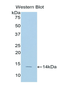 SELP / P-Selectin / CD62P Antibody - Western blot of recombinant SELP / P-Selectin / CD62P.  This image was taken for the unconjugated form of this product. Other forms have not been tested.