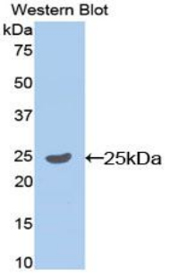 SELP / P-Selectin / CD62P Antibody - Western blot of recombinant SELP / P-Selectin / CD62P.  This image was taken for the unconjugated form of this product. Other forms have not been tested.