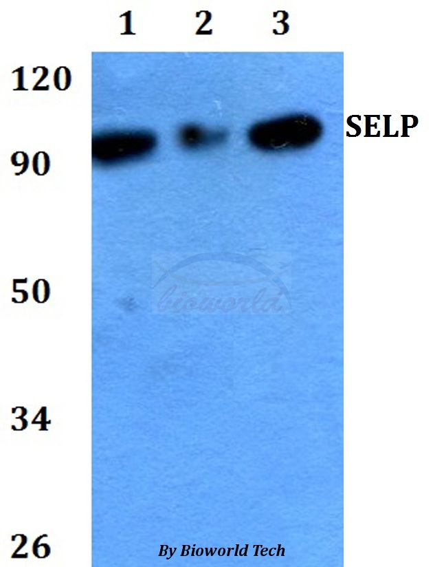 SELP / P-Selectin / CD62P Antibody - Western blot of SELP antibody at 1:500 dilution. Lane 1: HEK293T whole cell lysate. Lane 2: Raw264.7 whole cell lysate. Lane 3: PC12 whole cell lysate.