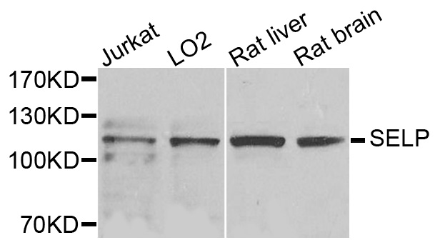SELP / P-Selectin / CD62P Antibody - Western blot analysis of extracts of various cell lines, using SELP antibody at 1:1000 dilution. The secondary antibody used was an HRP Goat Anti-Rabbit IgG (H+L) at 1:10000 dilution. Lysates were loaded 25ug per lane and 3% nonfat dry milk in TBST was used for blocking. An ECL Kit was used for detection and the exposure time was 10s.