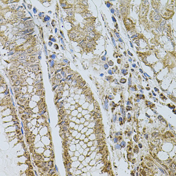 SELP / P-Selectin / CD62P Antibody - Immunohistochemistry of paraffin-embedded human stomach using SELP antibodyat dilution of 1:100 (40x lens).