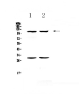 SELP / P-Selectin / CD62P Antibody - Western blot - Anti-CD62P Picoband antibody