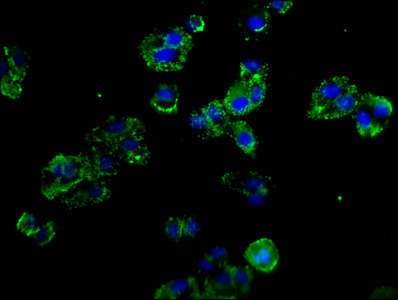 SELP / P-Selectin / CD62P Antibody - Immunofluorescence staining of HepG2 cells at a dilution of 1:100, counter-stained with DAPI. The cells were fixed in 4% formaldehyde, permeabilized using 0.2% Triton X-100 and blocked in 10% normal Goat Serum. The cells were then incubated with the antibody overnight at 4 °C.The secondary antibody was Alexa Fluor 488-congugated AffiniPure Goat Anti-Rabbit IgG (H+L) .
