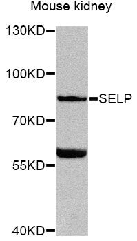 SELP / P-Selectin / CD62P Antibody - Western blot analysis of extracts of mouse kidney, using SELP Antibody at 1:1000 dilution. The secondary antibody used was an HRP Goat Anti-Rabbit IgG (H+L) at 1:10000 dilution. Lysates were loaded 25ug per lane and 3% nonfat dry milk in TBST was used for blocking. An ECL Kit was used for detection and the exposure time was 60s.