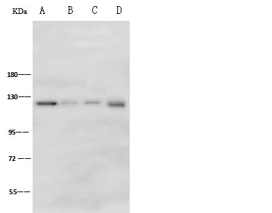 SELP / P-Selectin / CD62P Antibody - Anti-SELP rabbit polyclonal antibody at 1:500 dilution. Lane A: Jurkat Whole Cell Lysate. Lane B: Rat Liver tissue lysate. Lane C: Rat Spleen tissue lysate. Lane D: Rat Brain tissue lysate. Lysates/proteins at 30 ug per lane. Secondary: Goat Anti-Rabbit IgG (H+L)/HRP at 1/10000 dilution. Developed using the ECL technique. Performed under reducing conditions. Predicted band size: 91 kDa. Observed band size: 125 kDa.
