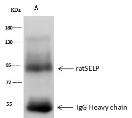 SELP / P-Selectin / CD62P Antibody - ratSELP was immunoprecipitated using: Lane A: 0.5 mg Jurkat Whole Cell Lysate. 0.5 uL anti-ratSELP rabbit polyclonal antibody and 60 ug of Immunomagnetic beads Protein A/G. Primary antibody: Anti-ratSELP rabbit polyclonal antibody, at 1:500 dilution. Secondary antibody: Goat Anti-Rabbit IgG (H+L)/HRP at 1/10000 dilution. Developed using the ECL technique. Performed under reducing conditions. Predicted band size: 91 kDa. Observed band size: 91 kDa.