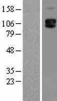 SELP / P-Selectin / CD62P Protein - Western validation with an anti-DDK antibody * L: Control HEK293 lysate R: Over-expression lysate