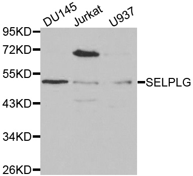 SELPLG / PSGL-1 / CD162 Antibody - Western blot analysis of extracts of various cell lines, using SELPLG antibody at 1:1000 dilution. The secondary antibody used was an HRP Goat Anti-Rabbit IgG (H+L) at 1:10000 dilution. Lysates were loaded 25ug per lane and 3% nonfat dry milk in TBST was used for blocking.
