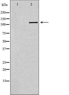 SELPLG / PSGL-1 / CD162 Antibody - Western blot analysis of extracts of Jurkat cells using SELPLG antibody. The lane on the left is treated with the antigen-specific peptide.