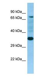 SELPLG / PSGL-1 / CD162 Antibody - SELPLG / PSGL-1 / CD162 antibody Western Blot of Fetal Heart.  This image was taken for the unconjugated form of this product. Other forms have not been tested.