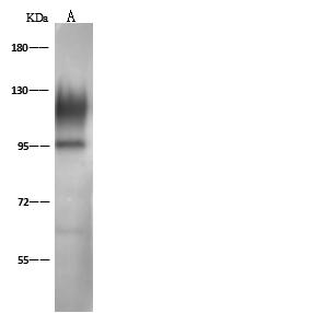 SELPLG / PSGL-1 / CD162 Antibody - Anti-SELPLG rabbit polyclonal antibody at 1:500 dilution. Lane A: HeLa Whole Cell Lysate. Lane B: Jurkat Whole Cell Lysate. Lysates/proteins at 30 ug per lane. Secondary: Goat Anti-Rabbit IgG (H+L)/HRP at 1/10000 dilution. Developed using the ECL technique. Performed under reducing conditions. Predicted band size: 43 kDa. Observed band size: 120 kDa. (We are unsure as to the identity of these extra bands.)