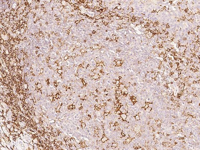 SELPLG / PSGL-1 / CD162 Antibody - Immunochemical staining of human SELPLG in human tonsil with rabbit polyclonal antibody at 1:500 dilution, formalin-fixed paraffin embedded sections.