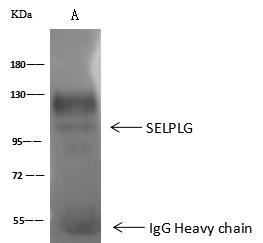 SELPLG / PSGL-1 / CD162 Antibody - SELPLG was immunoprecipitated using: Lane A: 0.5 mg Jurkat Whole Cell Lysate. 2 uL anti-SELPLG rabbit polyclonal antibody and 60 ug of Immunomagnetic beads Protein A/G. Primary antibody: Anti-SELPLG rabbit polyclonal antibody, at 1:100 dilution. Secondary antibody: Goat Anti-Rabbit IgG (H+L)/HRP at 1/10000 dilution. Developed using the ECL technique. Performed under reducing conditions. Predicted band size: 98 kDa. Observed band size: 98 kDa.