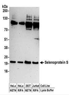 SELS Antibody - Detection of Human Selenoprotein S by Western Blot. Samples: Whole cell lysate (50 ug) prepared using NETN or RIPA buffer from HeLa, 293T, and Jurkat cells. Antibodies: Affinity purified rabbit anti-Selenoprotein S antibody used for WB at 0.4 ug/ml. Detection: Chemiluminescence with an exposure time of 3 minutes.