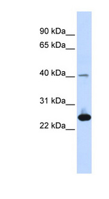 SELS Antibody - SELS antibody Western blot of Fetal Muscle lysate. This image was taken for the unconjugated form of this product. Other forms have not been tested.