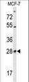 SELT / Selenoprotein T Antibody - Western blot of SELT Antibody in MCF-7 cell line lysates (35 ug/lane). SELT (arrow) was detected using the purified antibody.