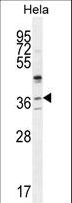 SELV Antibody - SELV Antibody western blot of HeLa cell line lysates (35 ug/lane). The SELV antibody detected the SELV protein (arrow).