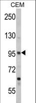 SEMA3A / Semaphorin 3A Antibody - Western blot of SEMA3A Antibody in CEM cell line lysates (35 ug/lane). SEMA3A (arrow) was detected using the purified antibody.