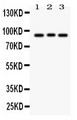 SEMA3A / Semaphorin 3A Antibody - Semaphorin 3A antibody Western blot. All lanes: Anti Semaphorin 3A at 0.5 ug/ml. Lane 1: 293T Whole Cell Lysate at 40 ug. Lane 2: A549 Whole Cell Lysate at 40 ug. Lane 3: HELA Whole Cell Lysate at 40 ug. Predicted band size: 89 kD. Observed band size: 89 kD.