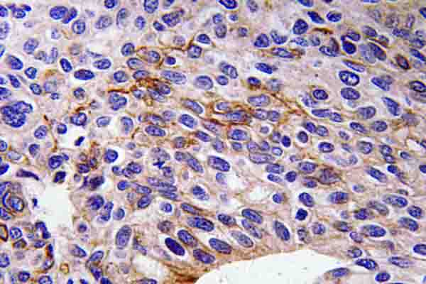 SEMA3A / Semaphorin 3A Antibody - IHC of SEMA3A (P737) pAb in paraffin-embedded human tonsil tissue.