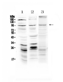 SEMA3A / Semaphorin 3A Antibody - Western blot - Anti-Semaphorin 3A Picoband Antibody