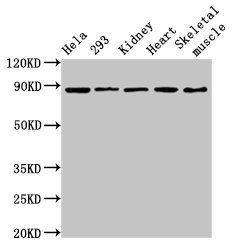 SEMA3A / Semaphorin 3A Antibody - Positive Western Blot detected in Hela whole cell lysate, 293 whole cell lysate, Rat kidney tissue, Mouse heart tissue, Mouse skeletal muscle. All lanes: SEMA3 antibody at 3.6 µg/ml Secondary Goat polyclonal to rabbit IgG at 1/50000 dilution. Predicted band size: 89 KDa. Observed band size: 89 KDa