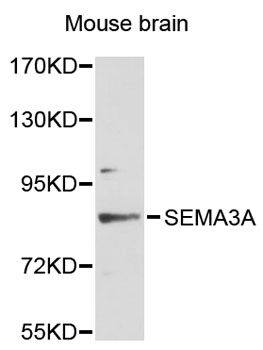 SEMA3A / Semaphorin 3A Antibody - Western blot analysis of extracts of mouse brain, using SEMA3A antibody at 1:3000 dilution. The secondary antibody used was an HRP Goat Anti-Rabbit IgG (H+L) at 1:10000 dilution. Lysates were loaded 25ug per lane and 3% nonfat dry milk in TBST was used for blocking. An ECL Kit was used for detection and the exposure time was 90s.